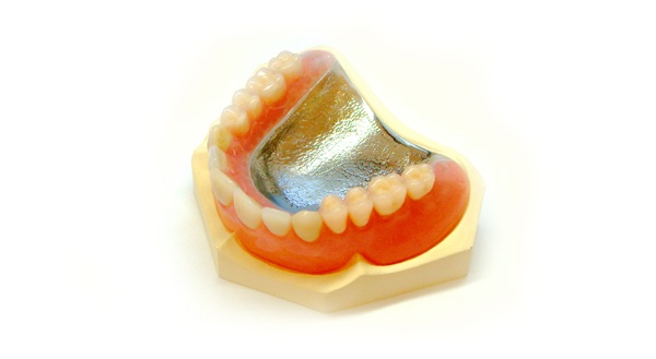 金属の入れ歯・チタンの総入れ歯