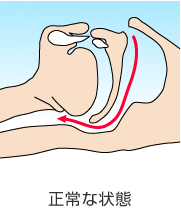 ���т��̌����E����ȏ�Ԃ̈��������E�C�r�L�O��