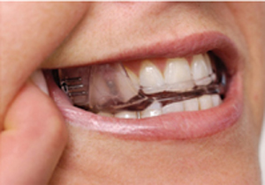 �����s�`�斃�z�\�ԁE���т��Ɛ��������ċz�ǌ�Q�̃}�E�X�s�[�X����