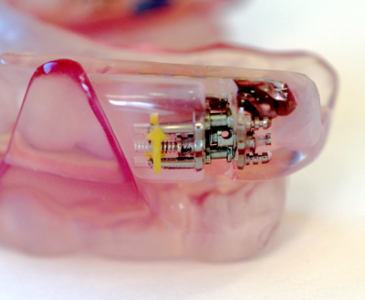 ���т��p�E���ċz�ǌ�Q�̐����}�E�X�s�[�X�̍\��