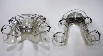 顎を拡げる矯正装置・拡大矯正・東京都港区麻布十番